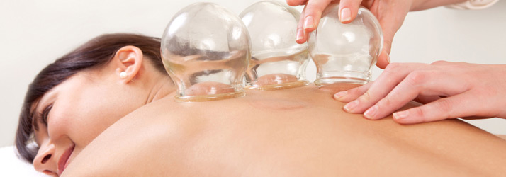 Medical Clinic Jacksonville IL Cupping Therapy
